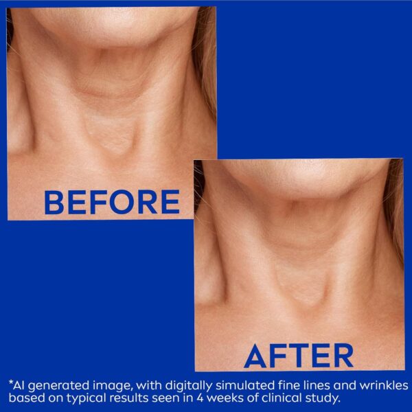 NIVEA Skin Firming and Anti Wrinkle Neck and Chest Cream with Q10, Creatine and Provitamin B5, Skin Firming Body Cream Reduces the Look of Fine Lines and Wrinkles, 6.7 Oz Tube