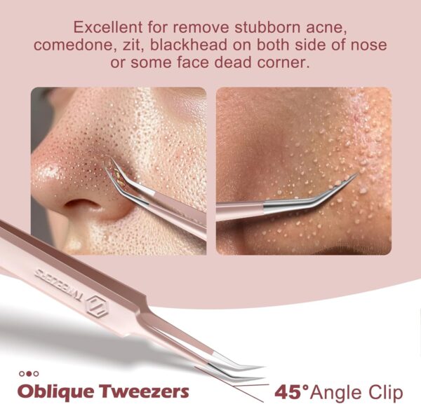 WSYUB Professional Facial Blackhead Remover Tweezers,Extractor Acne Removal, Pimple Popper Tool kit, Clip for Whiteheads, Acne Clip, Ingrown Hairs Tweezers, Blackheads Tweezers