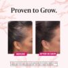 Viviscal Hair Growth Supplements For Women For Thicker, Fuller Hair, Nourishes Thinning & Loss, With Proprietary Collagen Complex, 180 Tablets, 3 Month Supply