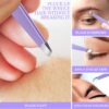 Teenitor Pimple Popper Tool Kit and Blackhead Remover Tools, Ingrown Hair Tweezers, Professional Blackhead Extractor Pimple Extractor Comedone Extractor, Black Head Remover for Face