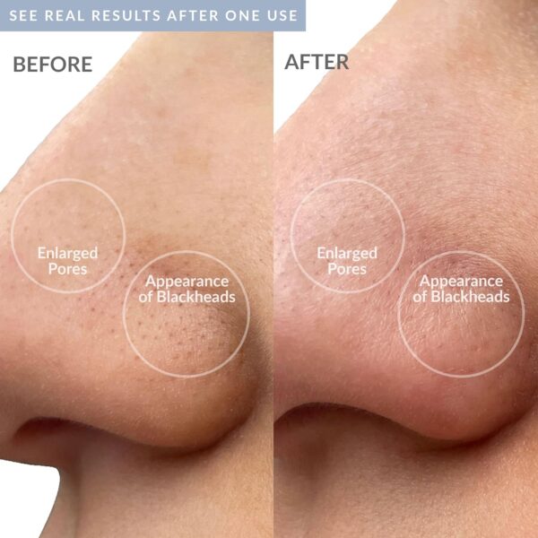 PMD Wave Pro - Professional-Grade Advanced Skin Spatula - Extract, Infuse, & Lift - SonicGlow Vibration and E-Wave Technology - Clear Pores, Blackheads, & Whiteheads