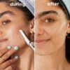 Gillette Venus Facial Razor, Exfoliating Dermaplaning Tool for Face, Replaceable Refills, Removes Fine Facial Hair, Exfoliates Dead Skin, Skin Defense Guard, Handle with 5 Blade Refills