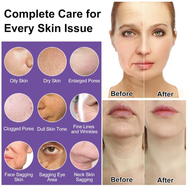 Skin Care Set,Professional Tighten Lift Firm Skincare for Women Teens Teenage Girl,Hydrate Anti-Aging Facial Skin Care Routine Kit,Travel Skincare Gift Set,Wife Mom Womens Gifts for Christmas Birthday