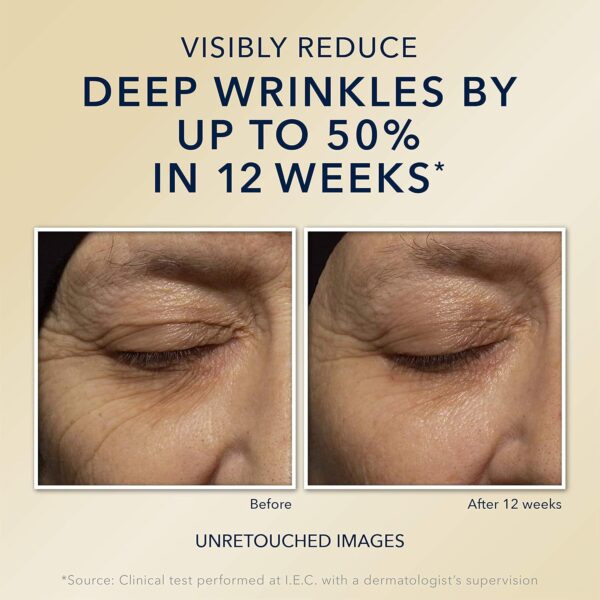 RoC Retinol Correxion Deep Wrinkle Anti-Aging Night Cream, Daily Face Moisturizer with Shea Butter, Glycolic Acid and Squalane, Skin Care Treatment, Mini 0.5 Ounces (Packaging May Vary)