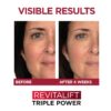 L'Oreal Paris Revitalift 1.5% Pure Hyaluronic Acid Face Serum + Triple Power Anti-Aging Face Moisturizer, 1 kit