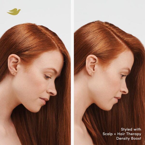 Dove Scalp + Hair Therapy Density Boost Serum Fullness Restore Visibly Thicker Hair In As Soon As 30 Days, Hydrating & Fast-Absorbing, Instantly Relieves Dry Scalp 2 Fl oz