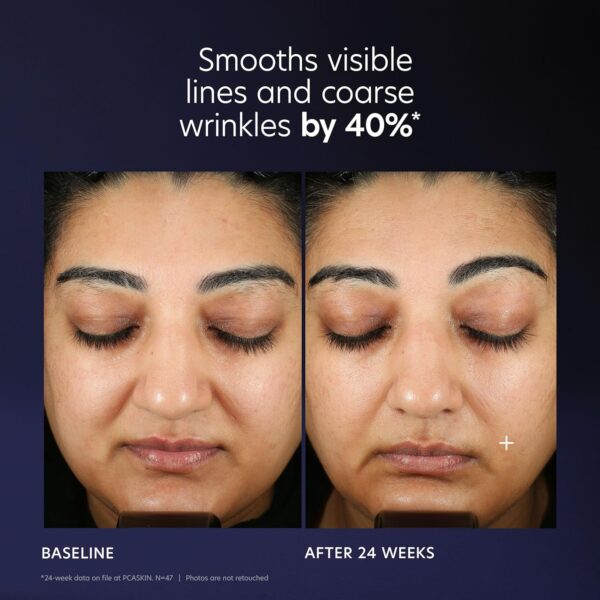 PCA SKIN Pro Max Age Renewal Anti Aging Serum, Anti Aging Face Serum for Reducing Wrinkles and Sagging Skin, Helps Lift and Firm Skin on Face and Neck, Safe For All Skin Types, 1.0 oz Pump Bottle