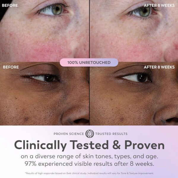 Olay Super Serum Trial Size - Niacinamide, Vitamin C & E, Collagen Peptide, AHA - 5-in-1 Skin Care Benefits - Healthy Glow, Brightening, Hydrating, Smoothing, Firming, Evens Tone, Anti-Aging, 0.4 Oz