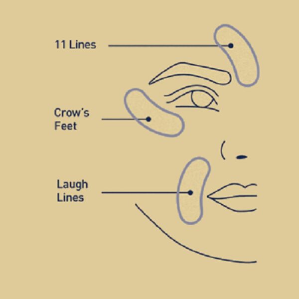 RoC Retinol Correxion Deep Wrinkle Non-Invasive Targeted Patches with Hyaluronic Acid + Firming Peptides for Forehead, 11 Lines, Crow’s Feet and Laugh Lines, (6 Patches) with Retinol Eye Packette