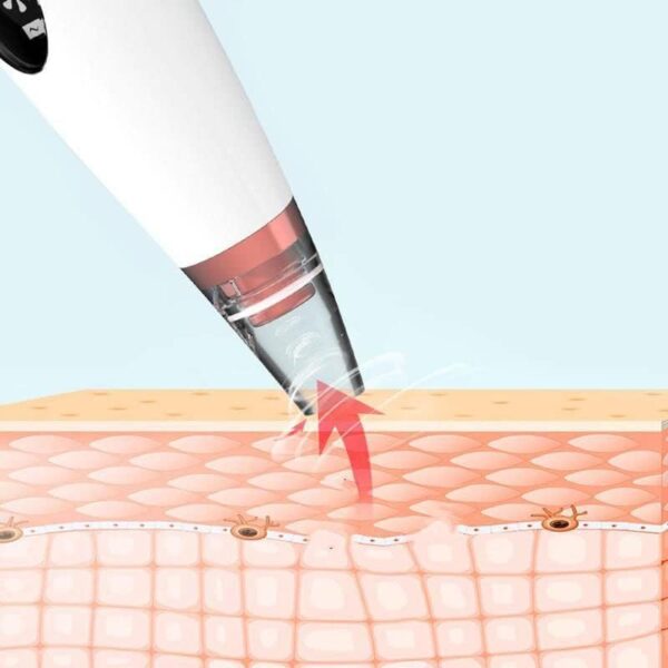 Electric Blackhead Remover Vacuum – Rechargeable Pore Cleaner with 6 Tips for Deep Cleansing & Anti-Aging Skincare