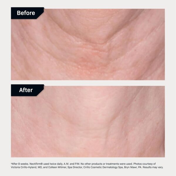 Revision Skincare Nectifirm®, Anti Aging Neck Firming Cream for Reducing Fine Lines, Wrinkles and Crepey Skin