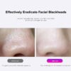 Fabufabu Blackhead Remover Pore Vacuum,Upgraded Facial Pore Cleaner,Electric Comedone Whitehead Extractor Tool-3 Suction Power,5 Probes,USB Rechargeable Blackhead Vacuum Kit for Women & Men