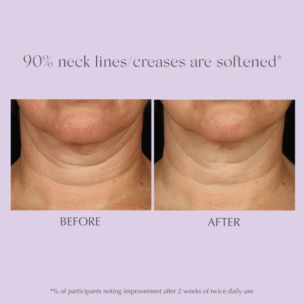 EXUVIANCE AGE REVERSE+ Toning and Firming Neck Cream, Tightens Fine Lines and Wrinkles, Evens Tone, Anti-Aging Décolletage Moisturizer with Advanced Peptide Formula, Bakuchiol, Vitamin E, 4.4 oz