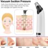 Advanced Electric Blackhead Remover Vacuum, Customizable Suction Levels, Interchangeable Heads, Ergonomic Design, Portable & USB-Chargeable, Electric Acne Extractor Tool, White