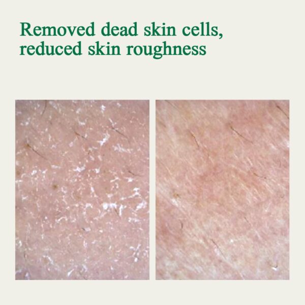 [PKY] Pyunkang Yul Ultimate Calming Solution Cream for Sensitive Skin with Patented Ingredients, Moisturizer Intensely Calms & Soothes Redness with Cica & Tea Tree, Korean Skincare (1.01 Fl. Oz, 30ml)