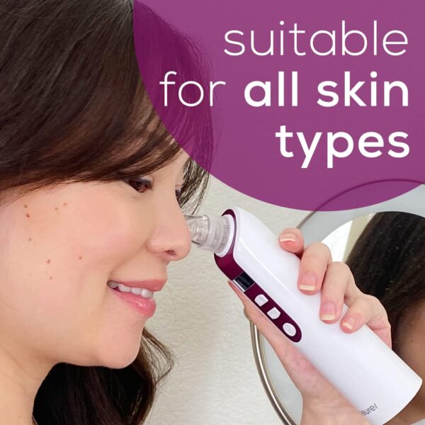 Beurer Blackhead Remover Pore Vacuum with 3 Suction Head Attachments & 5 Suction Levels, for All Skin Types - Blackhead Vacuum for Deep Cleansing, FC41