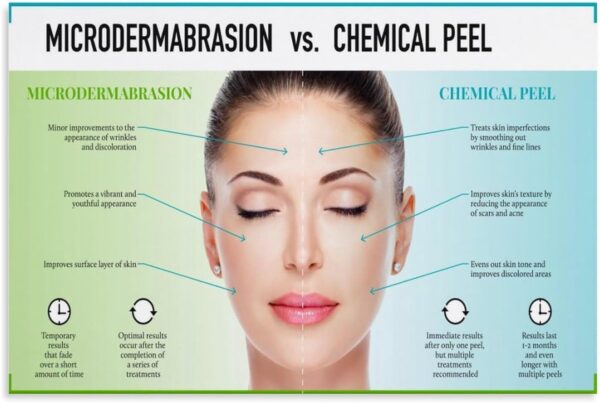 Microdermabrasion Vs Chemical Peel Poster (1) Canvas Print Wall Art Decoration Living Room Office Bedroom Aesthetic 24x16inch(60x40cm) Unframe-style