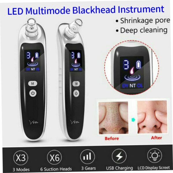 Blackhead Vacuum Remover USB Pore Acne Cleaner Nose Facial Care Whitehead Extractor Toolvacuum