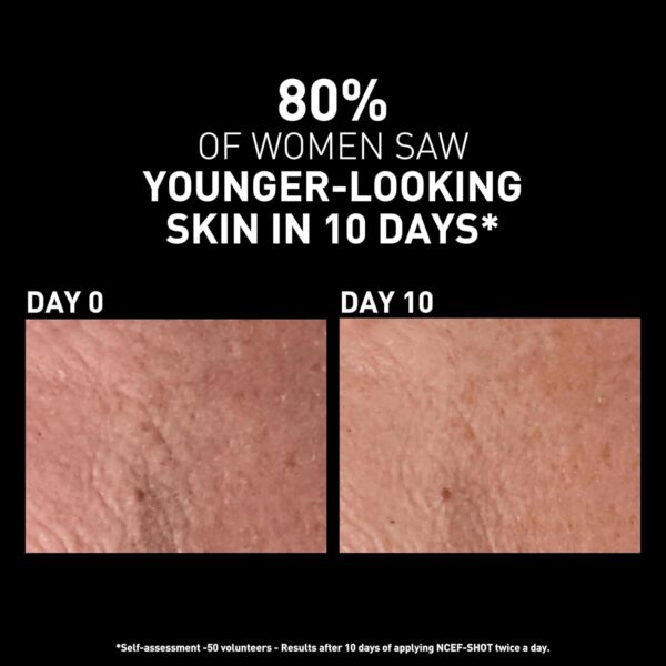 Filorga NCEF-Shot Anti-Aging Serum, Concentrated Wrinkle Reducing Treatment for Radiant & Firm Skin in 10 Days