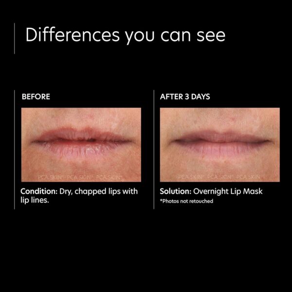 PCA SKIN Overnight Lip Mask — Ultra Hydrating Nighttime Mask Treatment to Nourish Lips (0.46 oz)