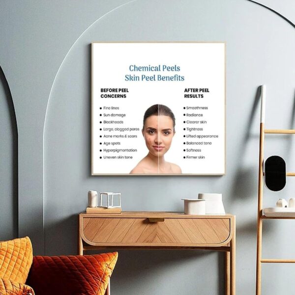 715FL5hfkOL._AC_SL1500_.jpg Microdermabrasion Vs Chemical Peel Poster (2) Canvas Print Wall Art Decoration Living Room Office Bedroom Aesthetic 16x16inch(40x40cm) Frame-style
