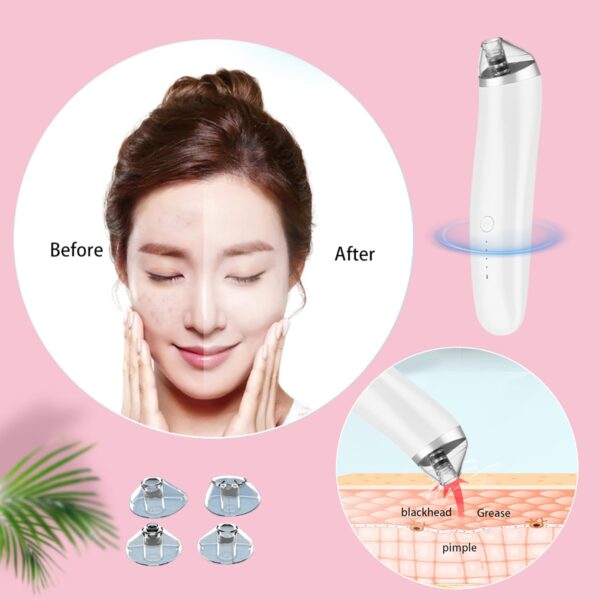 Pore Vacuum 3 Modes USB Charging Blackhead Remover Vacuum with 4 Suction Heads Blackhead Extractor Blackhead Remover Vacuum Electric Facial Pore Extractor Cleaner for Women & Men 2