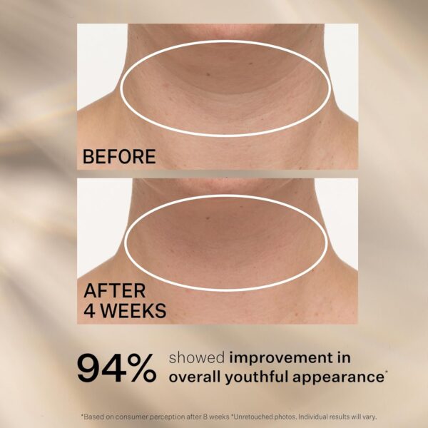 StriVectin Tighten & Lift Advanced Neck Cream PLUS with Alpha-3 Peptides for Neck & Décolleté, Smoothing Look of Wrinkles & Fine Lines, Improves Crepey Skin & Vertical Lines, for Soft Smooth Skin