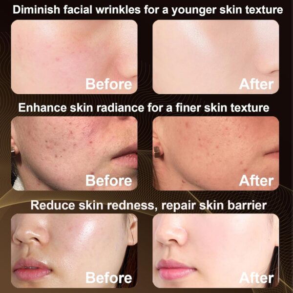 Red Light Therapy Mask, Pure Infrared 850 Red Light Face Mask Light Therapy, Portable Facial Led Mask Skincare