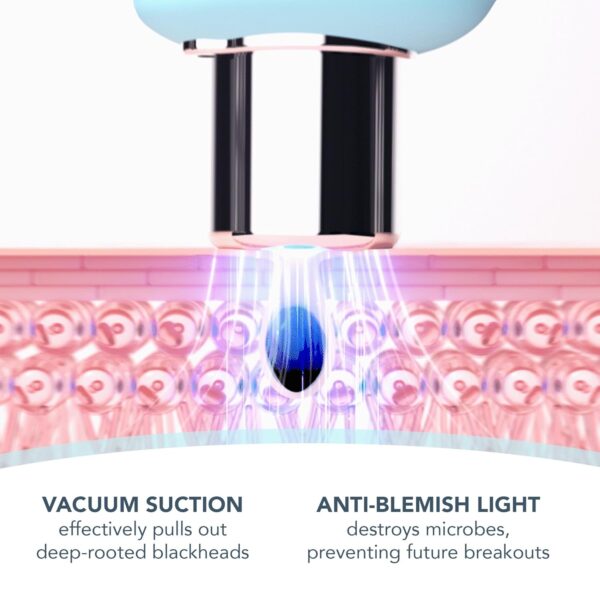 FOREO Blackheads Suck KIWI Bundle - Whitehead & Black Head Remover for Face + LUNA Micro-Foam Cleanser 2.0, 3.5 oz - Vacuum Skin Care Tools - Blackhead Extractor for Face & Nose - No Pore Strips