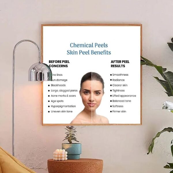 71SD28RcM2L._AC_SL1500_.jpg Microdermabrasion Vs Chemical Peel Poster (2) Canvas Print Wall Art Decoration Living Room Office Bedroom Aesthetic 16x16inch(40x40cm) Frame-style