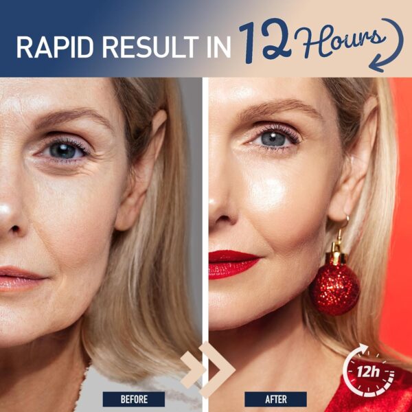 Enaskin Naturals Instant Eye & Face Lift Cream - Rapid Tightener and Wrinkle Filler for Deep Wrinkles - 0.5 oz