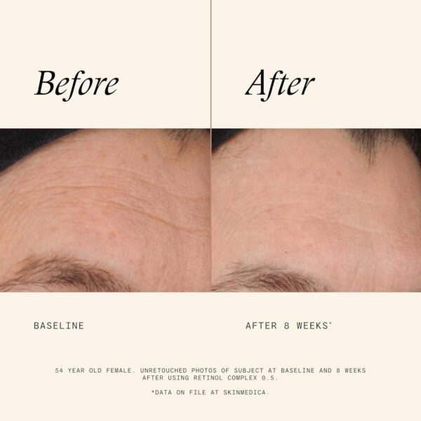 SkinMedica Retinol 0.5 Complex - Retinol Serum for Face, Age-Defying Advanced Retinol Cream That Renews Skin and Diminishes the Appearance of Fine Lines and Wrinkles, 1 Fl Oz