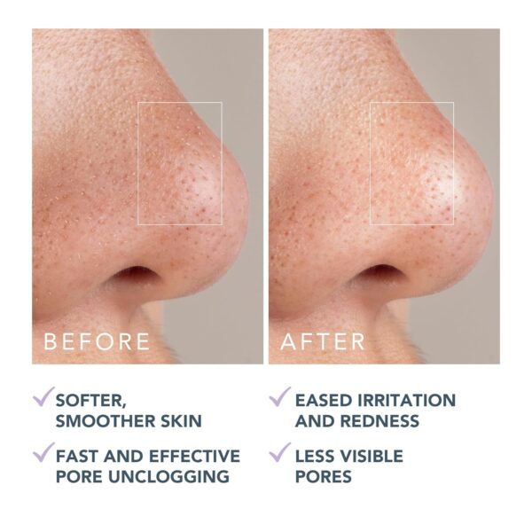 FOREO KIWI Active Pore & Blackhead Mask, 3.5 oz - Blackhead Remover - Clay Mask & moisturizing Jojoba Oil - Pore Minimizer - Skin Purifying & Detox Face Mask - Vegan & Cruelty-free - All Skin Types