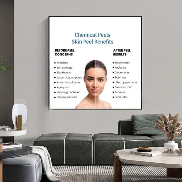 71kBlvqff5L._AC_SL1500_.jpg Microdermabrasion Vs Chemical Peel Poster (2) Canvas Print Wall Art Decoration Living Room Office Bedroom Aesthetic 16x16inch(40x40cm) Frame-style