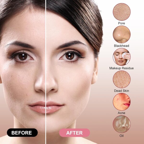 Facial Sonic Cleansing Brush, Rechargeable Waterproof Exfoliating Makeup Remover Massage Electric Cleansing Instrument, Men's and Women's Facial Wash - Pink