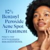 Differin Acne Spot Treatment with 10% Benzoyl Peroxide, Maximum Strength OTC Acne Treatment, Fast Acting Spot Treatment for Face, 1 oz