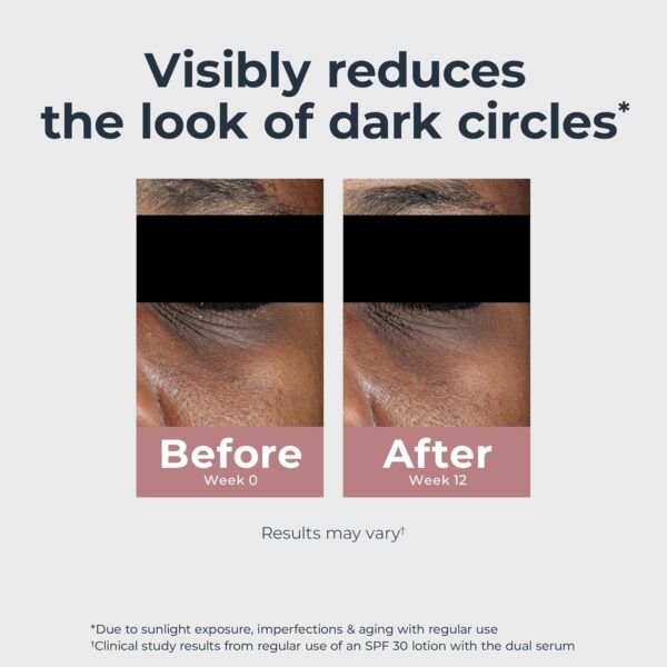 Eucerin Radiant Tone Eye Cream Dark Circle Corrector, Eye Brightening Cream with Thiamidol and Hyaluronic Acid, Helps Reduce the Look of Eye Puffiness, 0.5 Oz Tube