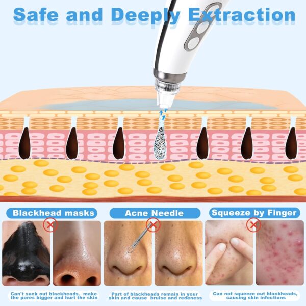 Blackhead Remover, EUASOO USB Rechargeable Pimple Extractor, Electric Pore Vacuum Blackhead Remover Tools for Women & Men, Blackhead Vacuum Kit with 10 * Filter Sponge & 5 * Rubber Ring & etc.
