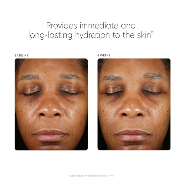 PCA SKIN Hyaluronic Acid Boosting Face Serum, Hyaluronic Acid Serum for Face Made with Niacinamide and Ceramides, Helps Reduce Fine Lines and Wrinkles and Delivers 24-Hour Moisturization, 1 oz Pump