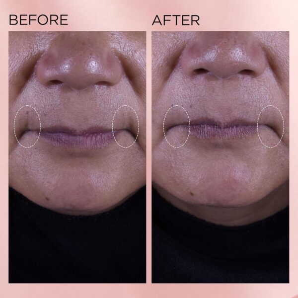 Elizabeth Arden Retinol Serum Wrinkle Filler + HPR Next Generation Retinoid, Ceramide, and Peptide Rapid Skin Renewing Water Day and Night Cream for Face and Neck