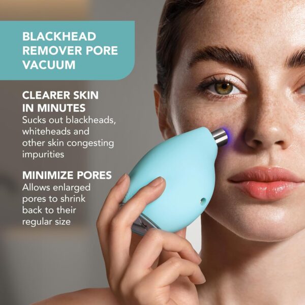 FOREO KIWI Whitehead & Black Head Remover for Face - Facial Skin Care Tools - Blackhead Extractor for Face & Nose - No Pore Strips Suction - Quick & Effective Blackhead Remover Device