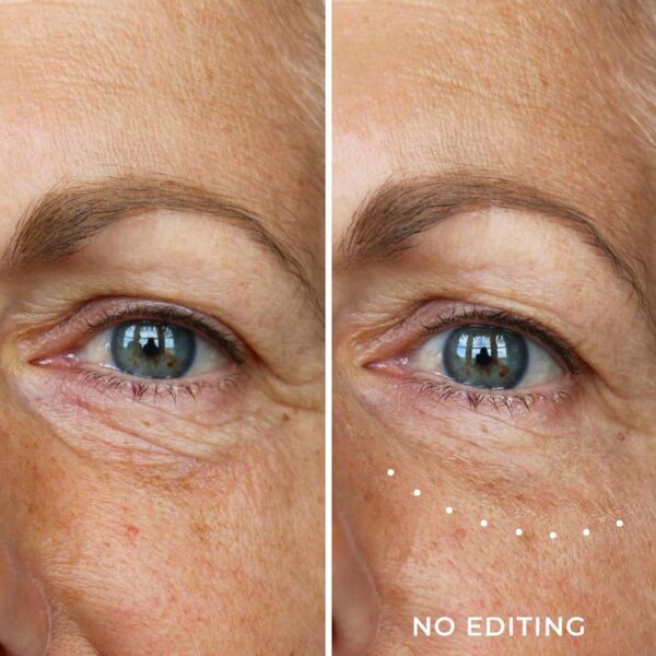 WUNDER2 Wunderlift Instant Eye Tightening Serum, Temporary Firming & Lifting Treatment in 60 Seconds, Reduces Under-Eye Bags, Dark Circles, Puffiness, Anti-aging Fine Lines