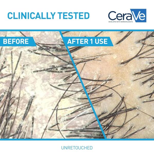 CeraVe 2 In 1 Hydrating Anti Dandruff Shampoo And Conditioner, 1% Pyrithione Zinc Dandruff Treatment, Color Safe & Sulfate Free Shampoo And Conditioner, Helps Eliminate Dandruff & Relieve Itchy Scalp