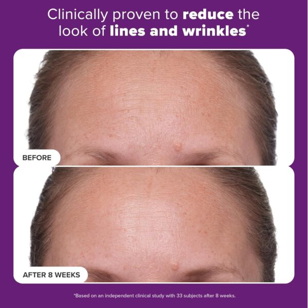 Paula's Choice CLINICAL 1% Retinol Treatment Cream with Peptides, Vitamin C & Licorice Extract, Anti-Aging & Wrinkles