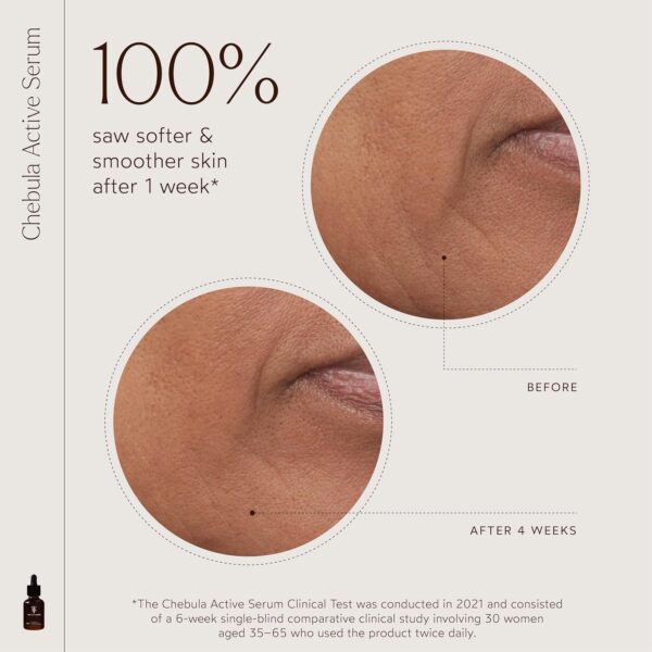 True Botanicals Chebula Active Serum | Optimizes Skins Collagen Levels | Anti-Aging Serum | Treats Fine Lines & Wrinkles | All Skin Types | Dermatologist Tested, All Natural, Vegan | 1 fl oz | 30 ml