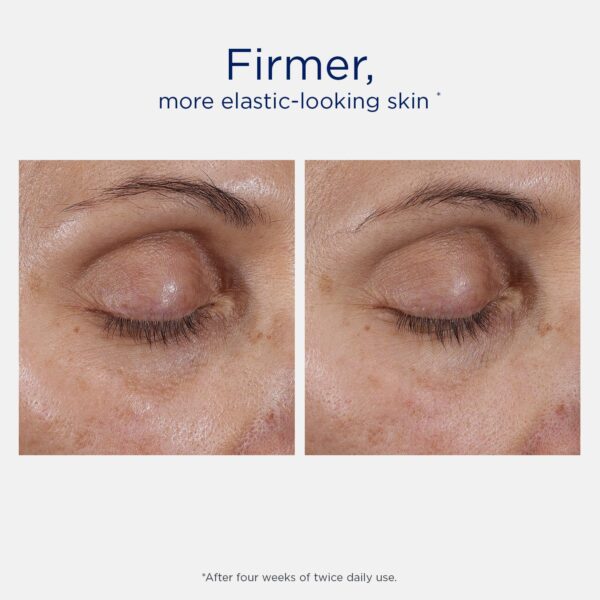 NEOSTRATA SKIN ACTIVE Intensive Eye Therapy, Anti Aging Under Eye Ceam, Treats Dark Circles, Puffiness, Fine Lines and Wrinkles with Hyaluronic Acid, Peptides and Bakuchiol, 0.5 oz