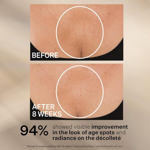 StriVectin Tighten & Lift Advanced Neck Cream PLUS with Alpha-3 Peptides for Neck & Décolleté, Smoothing Look of Wrinkles & Fine Lines, Improves Crepey Skin & Vertical Lines, for Soft Smooth Skin