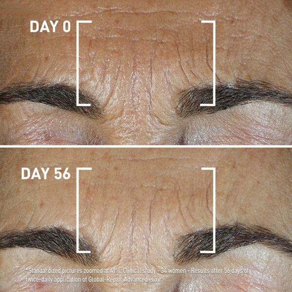 Filorga Global-Repair Advanced Elixir, Anti-Aging Face Treatment Repairs the Skin Barrier with a Rejuvenating Formula of Ceramides, Precious Oils, & Rose Extract to Reduce Wrinkles, 1.01 fl oz