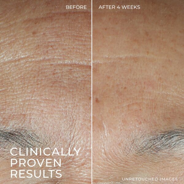 RoC Hydration+ Hyaluronic Acid Serum for Face, Hydrating, Plumping, Fragrance Free, Lightweight Formula with Collagen Proteins (1 Ounce) with Retinol Eye Cream Packette