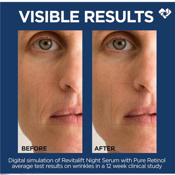 81cFT4Sy8lL._SL1500_.jpg L'Oreal Paris Revitalift 0.3% Pure Retinol Night Serum, Reduce Deep Wrinkles, Fragrance Free 1 oz + Moisturizer Sample